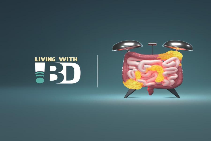 IBD Diet Consultation in Pune illustration showing inflamed intestine and digestive system concept for inflammatory bowel disease management